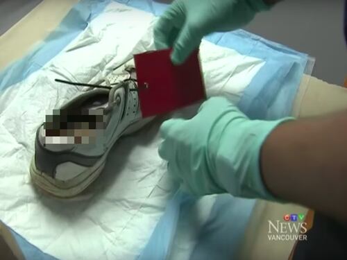 Canada, ancora un piede mozzato in spiaggia. Ma il giallo è (quasi) risolto