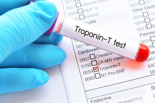 Complicanze e rischio infarto per i pazienti Covid con alti livelli di troponina