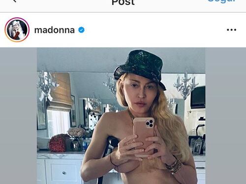 Seno nudo e stampella, il topless di Madonna spiazza i fan