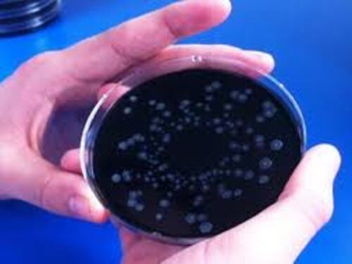 Polmoniti a Brescia, l'assessore: forse è legionella, il batterio nelle tubature