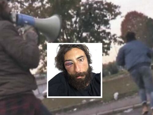 Se l'aggressione a Striscia non fa notizia come la testata di Ostia