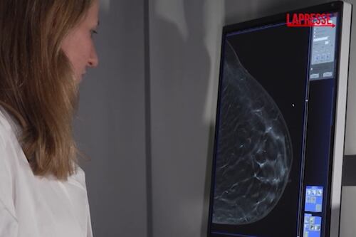Tumori: per prevenzione carcinoma mammella a SYNLAB Manifattura Firenze nuovo mammografo 3D