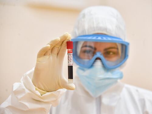 Super anticorpi anti-Covid prodotti in Italia, ma vietati. Gli scienziati al governo: "Basta aspettare"