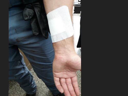 Roma violenta, poliziotto aggredito in servizio
