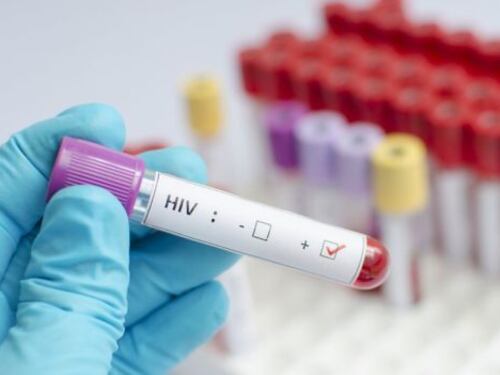 Aids, l'untore romano si difende: non sono un mostro, su di me solo falsità