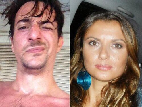 Bruciò viva la ex incinta, confermata la condanna a 18 anni