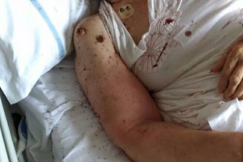 Formiche nel letto a Napoli, il ministro Lorenzin: "Fatto indegno, inviata una task force in ospedale"