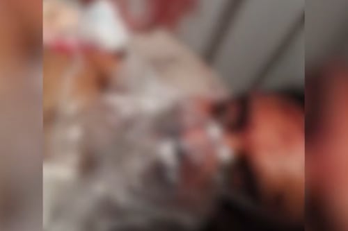 Terrore sul volo Dubai-Tel Aviv, il video choc del pilota accoltellato