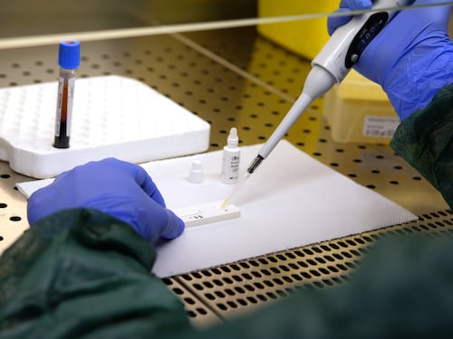 Manca un topo, test in ritardo sul vaccino anti-Covid