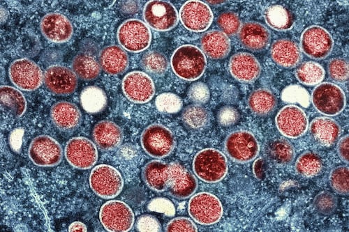 Vaiolo delle scimmie, New York è l'epicentro dell'epidemia in Usa. Dichiarata l'emergenza