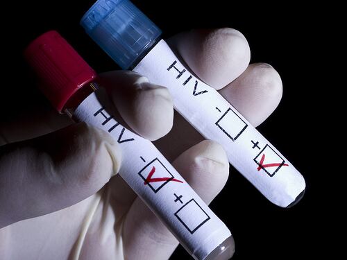 Firenze, rapporti non protetti sapendo di avere l'Hiv. Arrestato l'untore