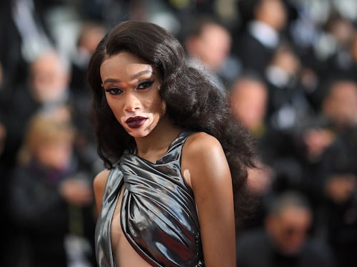 Winnie Harlow, la modella con la vitiligine incanta a Cannes