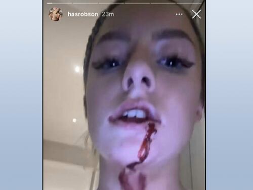 La fidanzata pubblica lividi e sangue sul volto, arrestato giocatore del Manchester