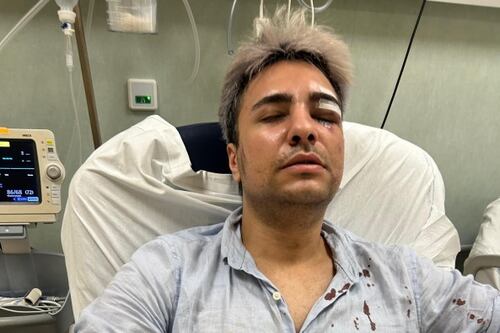 Roma, gli insulti omofobi poi il pestaggio. Ragazzo di 25 anni aggredito dal branco