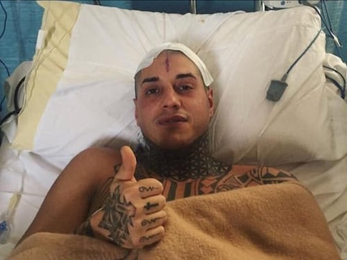 Chiofalo rassicura i fan dopo l'operazione: "Sto bene"