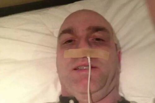 Un cavo dell’iPhone nel naso per simulare un cancro: la folle truffa della stella dell'hurling